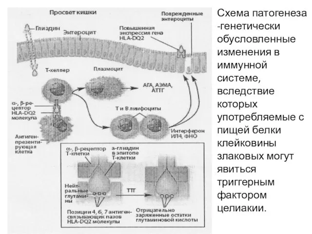 Схема патогенеза -генетически обусловленные изменения в иммунной системе, вследствие которых употребляемые