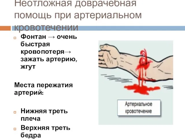 Неотложная доврачебная помощь при артериальном кровотечении Фонтан → очень быстрая кровопотеря→