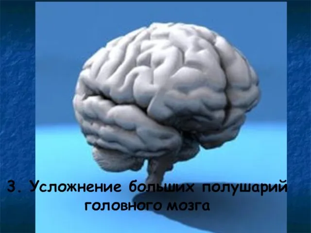 3. Усложнение больших полушарий головного мозга 3. Усложнение больших полушарий головного мозга