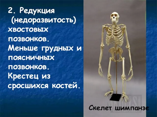 2. Редукция (недоразвитость) хвостовых позвонков. Меньше грудных и поясничных позвонков. Крестец из сросшихся костей. Скелет шимпанзе