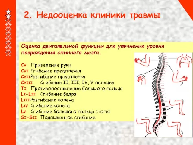 2. Недооценка клиники травмы Оценка двигательной функции для уточнения уровня повреждения