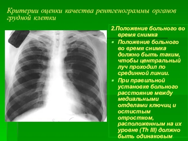 Критерии оценки качества рентгенограммы органов грудной клетки 2.Положение больного во время