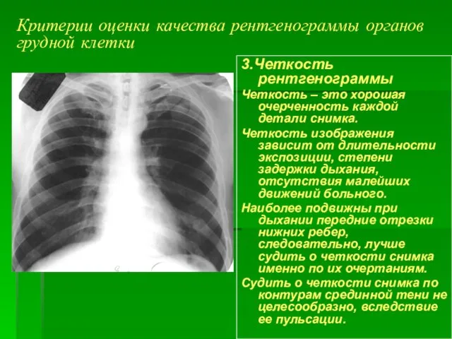 Критерии оценки качества рентгенограммы органов грудной клетки 3.Четкость рентгенограммы Четкость –