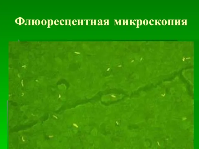 Флюоресцентная микроскопия