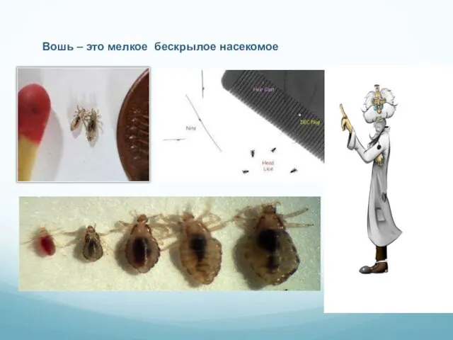 Вошь – это мелкое бескрылое насекомое