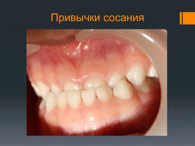 Привычки сосания