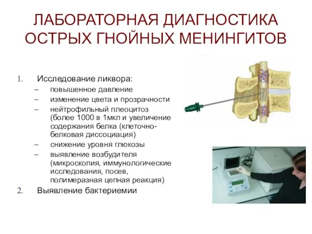 ЛАБОРАТОРНАЯ ДИАГНОСТИКА ОСТРЫХ ГНОЙНЫХ МЕНИНГИТОВ Исследование ликвора: повышенное давление изменение цвета