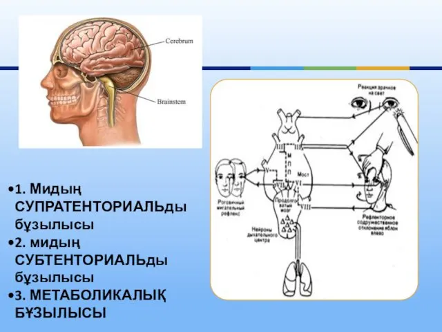 1. Мидың СУПРАТЕНТОРИАЛЬды бұзылысы 2. мидың СУБТЕНТОРИАЛЬды бұзылысы 3. МЕТАБОЛИКАЛЫҚ БҰЗЫЛЫСЫ