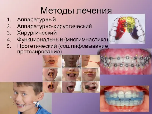 Методы лечения Аппаратурный Аппаратурно-хирургический Хирургический Функциональный (миогимнастика) Протетический (сошлифовывание, протезирование)