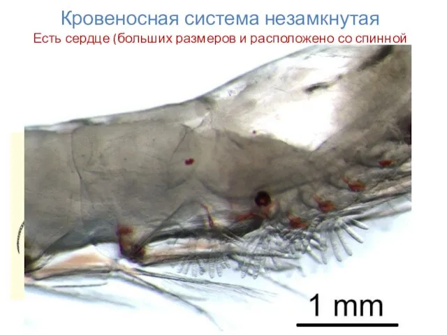 Кровеносная система незамкнутая Есть сердце (больших размеров и расположено со спинной
