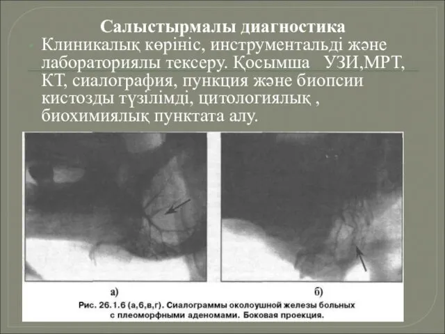 Салыстырмалы диагностика Клиникалық көрініс, инструментальді және лабораториялы тексеру. Қосымша УЗИ,МРТ,КТ, сиалография,