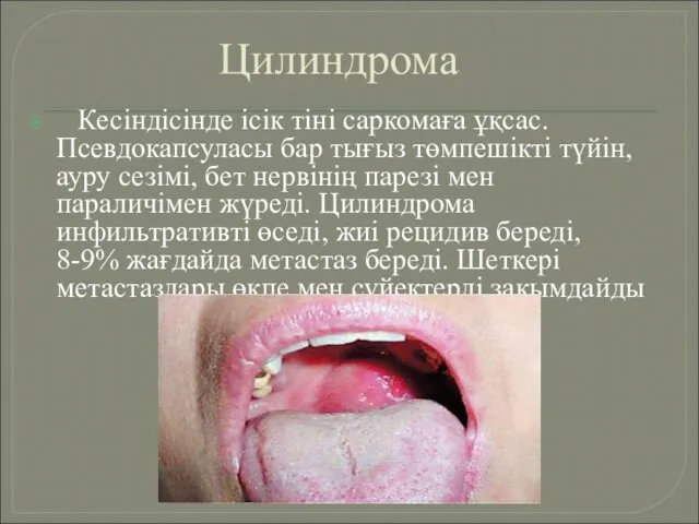 Цилиндрома Кесіндісінде ісік тіні саркомаға ұқсас. Псевдокапсуласы бар тығыз төмпешікті түйін,