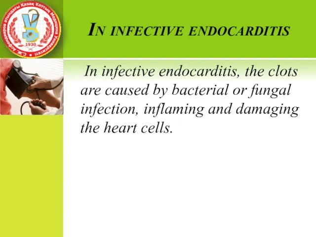 In infective endocarditis In infective endocarditis, the clots are caused by