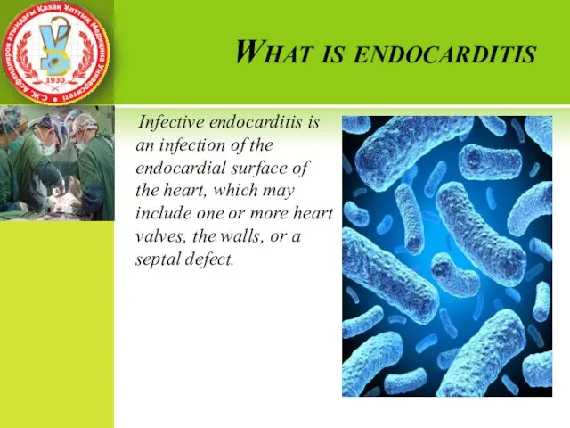 What is endocarditis Infective endocarditis is an infection of the endocardial
