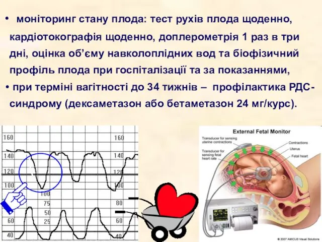 моніторинг стану плода: тест рухів плода щоденно, кардіотокографія щоденно, доплерометрія 1