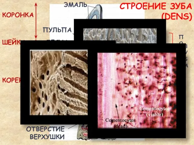 КОРОНКА ШЕЙКА КОРЕНЬ ПЕРИ- ОДОНТ ЦЕМЕНТ ПОЛОСТЬ КОРОНКИ ЭМАЛЬ ОТВЕРСТИЕ ВЕРХУШКИ