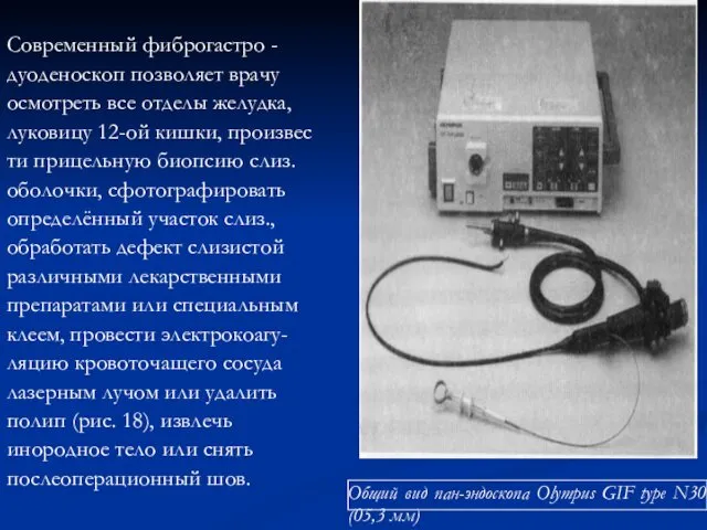 Современный фиброгастро - дуоденоскоп позволяет врачу осмотреть все отделы желудка, луковицу