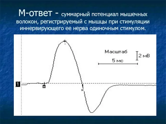 М-ответ - суммарный потенциал мышечных волокон, регистрируемый с мышцы при стимуляции иннервирующего ее нерва одиночным стимулом.