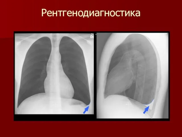 Рентгенодиагностика