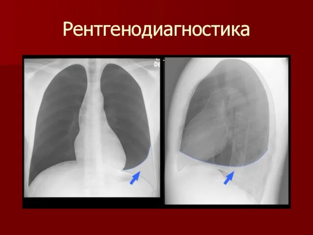 Рентгенодиагностика