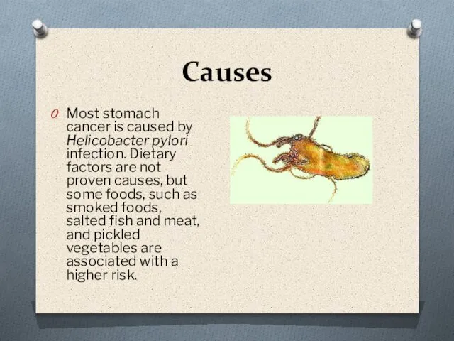 Causes Most stomach cancer is caused by Helicobacter pylori infection. Dietary