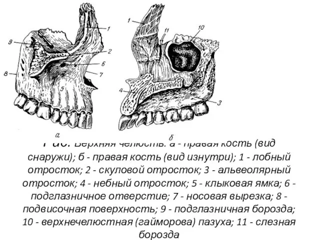 Рис. Верхняя челюсть. а - правая кость (вид снаружи); б -