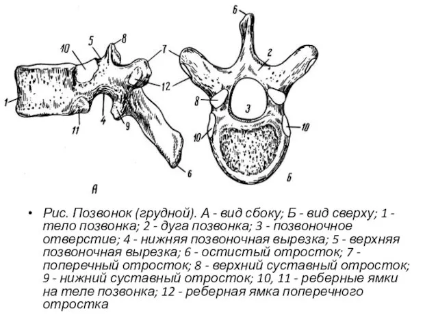 Рис. Позвонок (грудной). А - вид сбоку; Б - вид сверху;