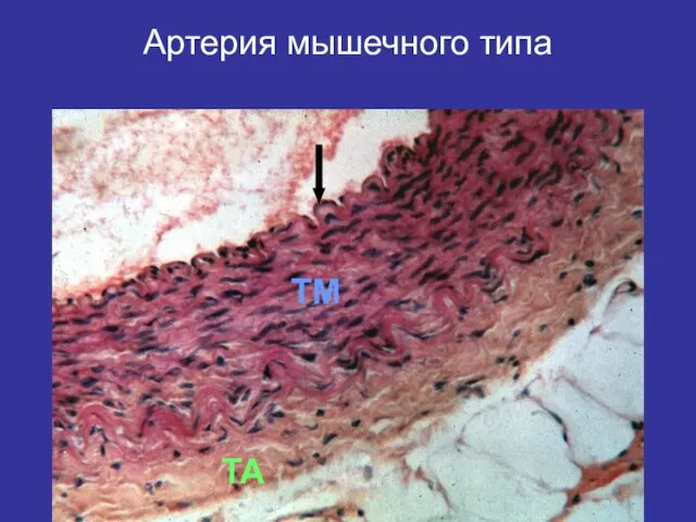 Артерия мышечного типа TM TA