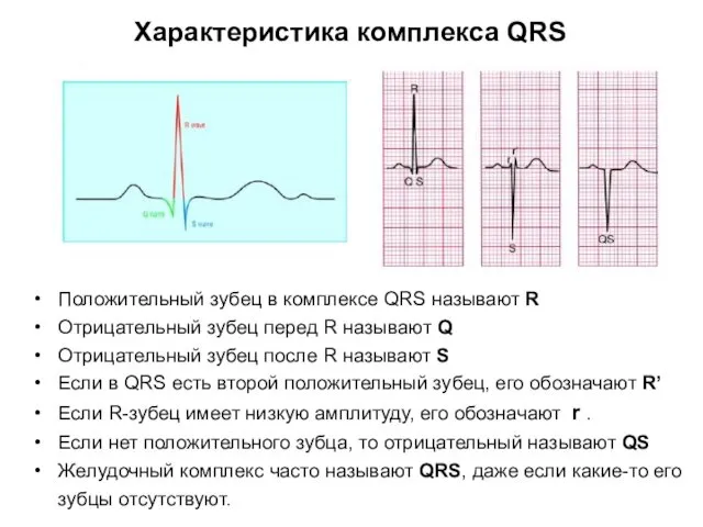 Положительный зубец в комплексе QRS называют R Отрицательный зубец перед R