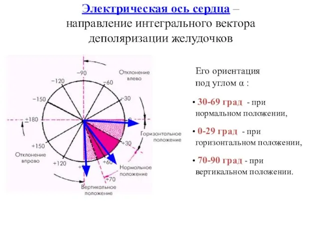 Электрическая ось сердца – направление интегрального вектора деполяризации желудочков Его ориентация