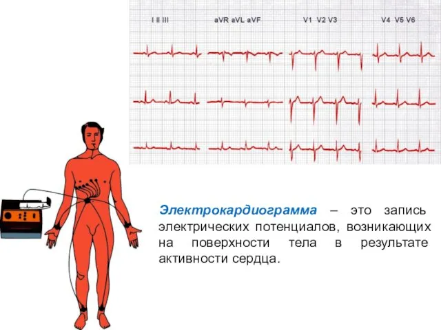 Электрокардиограмма – это запись электрических потенциалов, возникающих на поверхности тела в результате активности сердца.