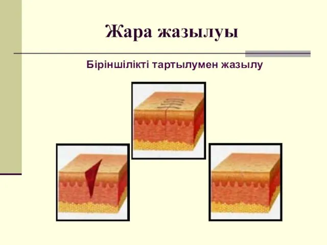 Жара жазылуы Біріншілікті тартылумен жазылу