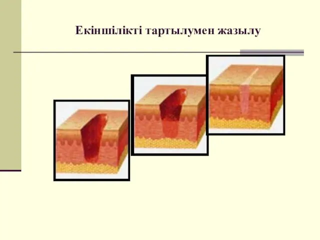 Екіншілікті тартылумен жазылу