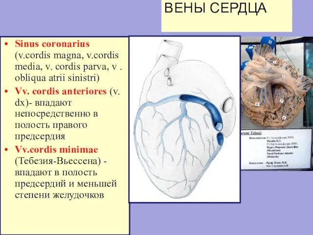 ВЕНЫ СЕРДЦА Sinus coronarius (v.cordis magna, v.cordis media, v. cordis parva,