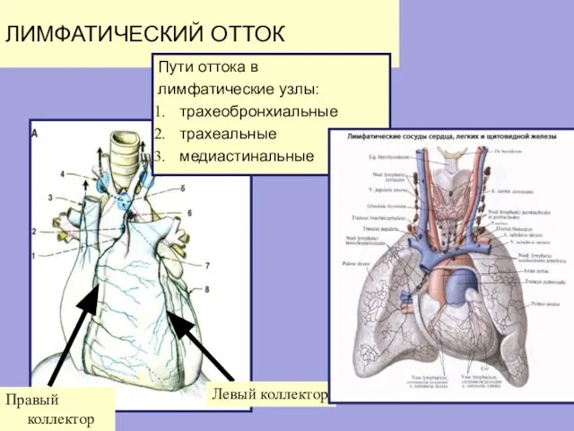 ЛИМФАТИЧЕСКИЙ ОТТОК Пути оттока в лимфатические узлы: трахеобронхиальные трахеальные медиастинальные Левый коллектор Правый коллектор