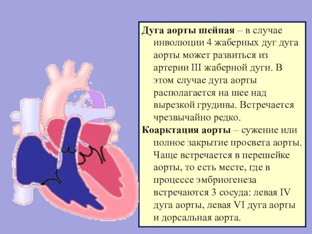 Дуга аорты шейная – в случае инволюции 4 жаберных дуг дуга