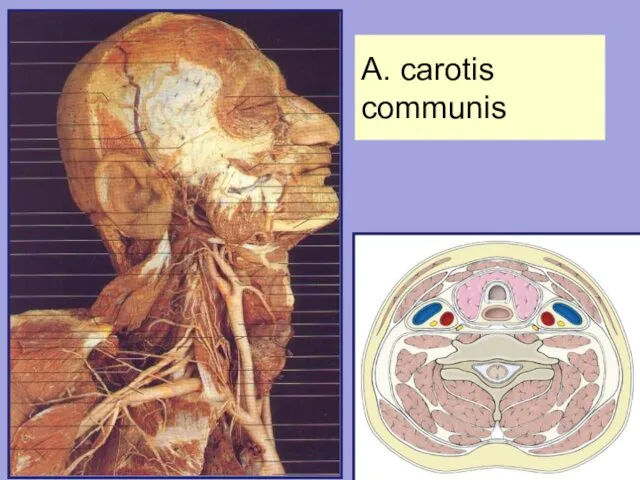 A. carotis communis