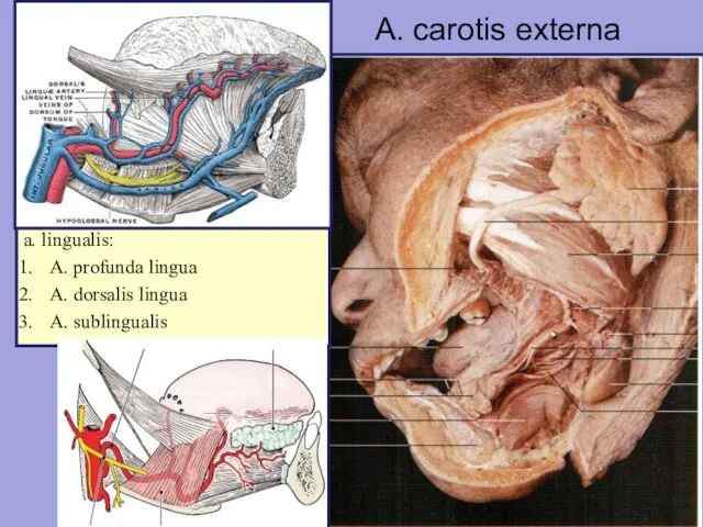 A. carotis externa a. lingualis: A. profunda lingua A. dorsalis lingua A. sublingualis