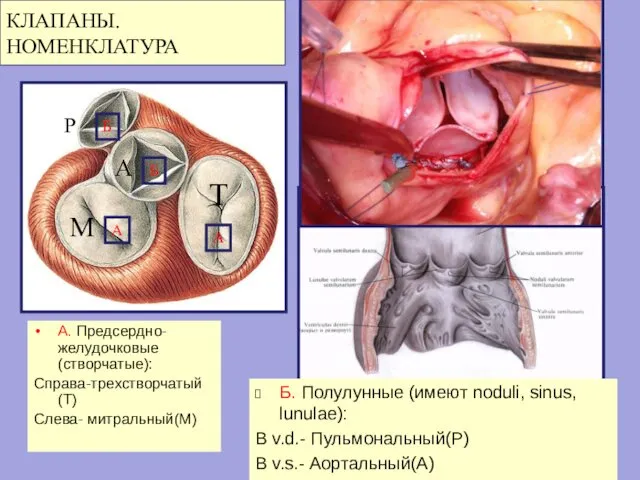 КЛАПАНЫ. НОМЕНКЛАТУРА А. Предсердно-желудочковые (створчатые): Справа-трехстворчатый(T) Слева- митральный(M) Б. Полулунные (имеют