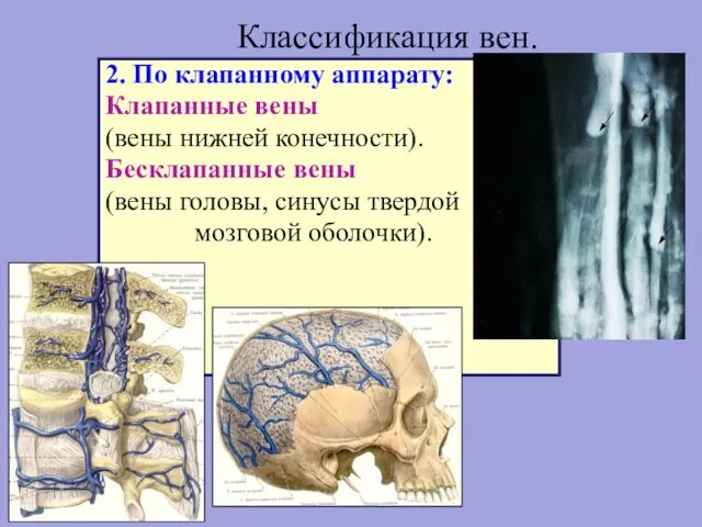 Классификация вен. 2. По клапанному аппарату: Клапанные вены (вены нижней конечности).