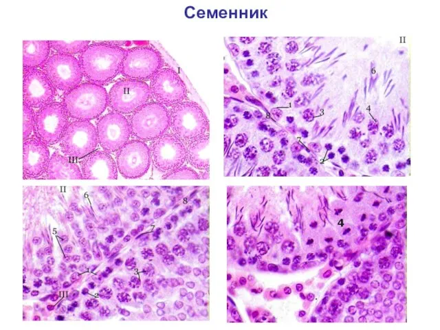 Семенник 4