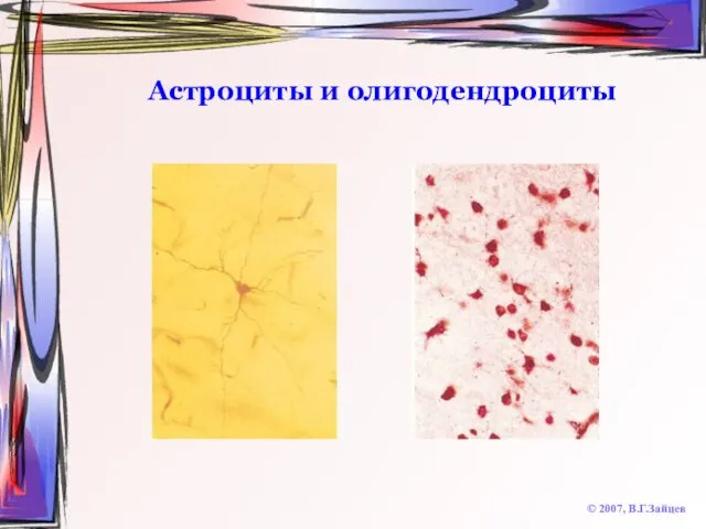 Астроциты и олигодендроциты © 2007, В.Г.Зайцев