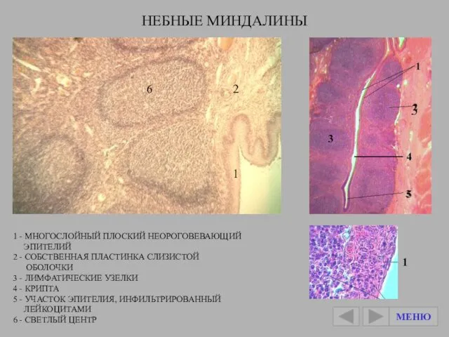 1 - МНОГОСЛОЙНЫЙ ПЛОСКИЙ НЕОРОГОВЕВАЮЩИЙ ЭПИТЕЛИЙ 2 - СОБСТВЕННАЯ ПЛАСТИНКА СЛИЗИСТОЙ