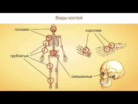 Виды костей короткие смешанные трубчатые плоские