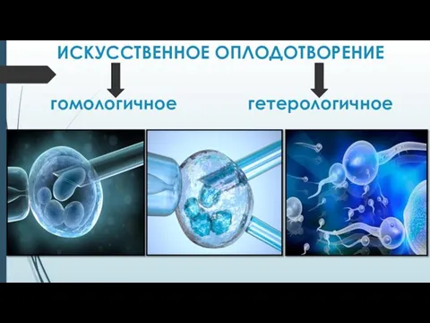 ИСКУССТВЕННОЕ ОПЛОДОТВОРЕНИЕ гомологичное гетерологичное