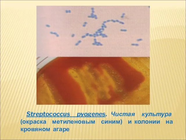 Streptococcus pyogenes. Чистая культура (окраска метиленовым синим) и колонии на кровяном агаре