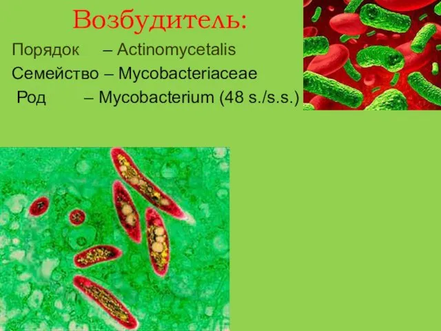 Возбудитель: Порядок – Actinomycetalis Семейство – Mycobacteriaceae Род – Mycobacterium (48 s./s.s.)