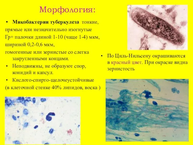 Морфология: Микобактерии туберкулеза тонкие, прямые или незначительно изогнутые Гр+ палочки длиной
