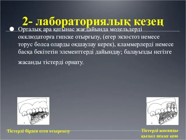 2- лабораториялық кезең Орталық ара қатынас жағдайында модельдерді окклюдаторға гипске отырғызу,