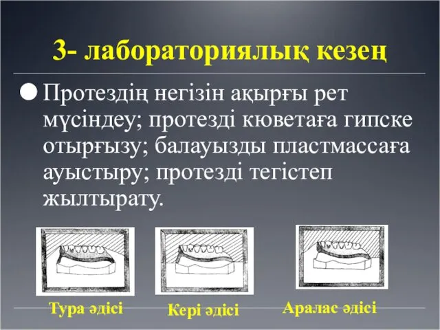 3- лабораториялық кезең Протездің негізін ақырғы рет мүсіндеу; протезді кюветаға гипске